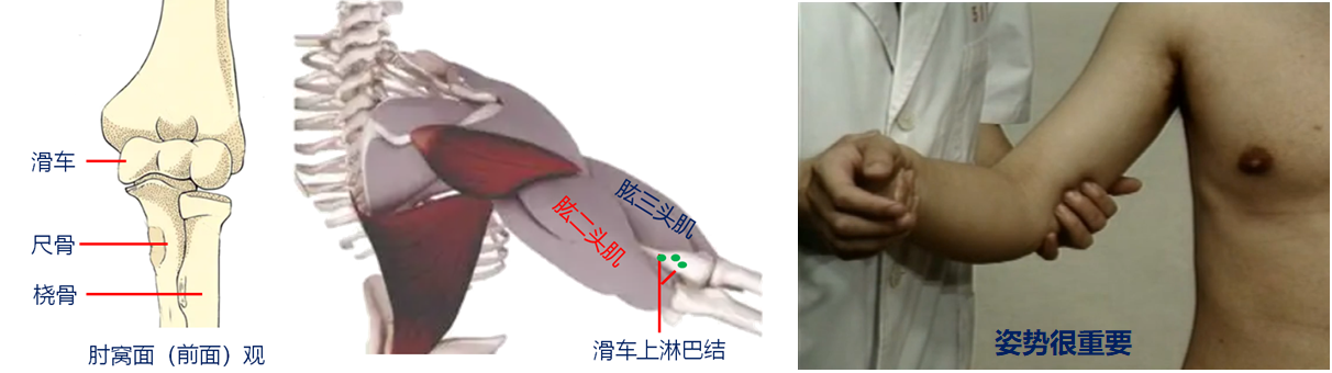 13.png